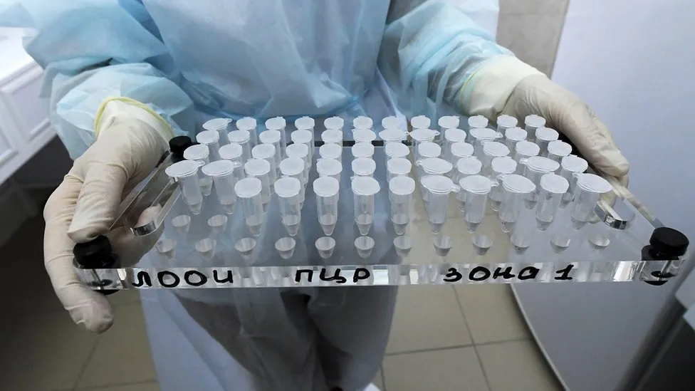 В Абхазии выявлено 108 новых случаев коронавируса 1 111118634 c0482507 testing for covid 19 infection spl Covid-19 Covid-19