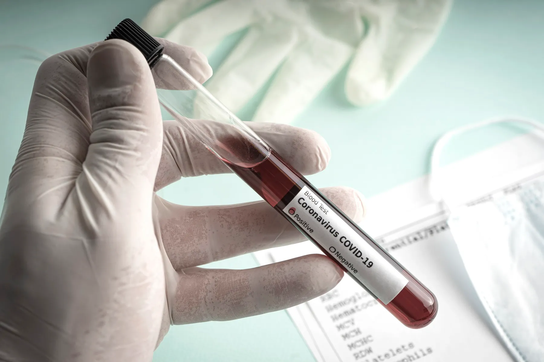 hand in gloves holds a test tube containing a bloo AKDRVWL новости новости