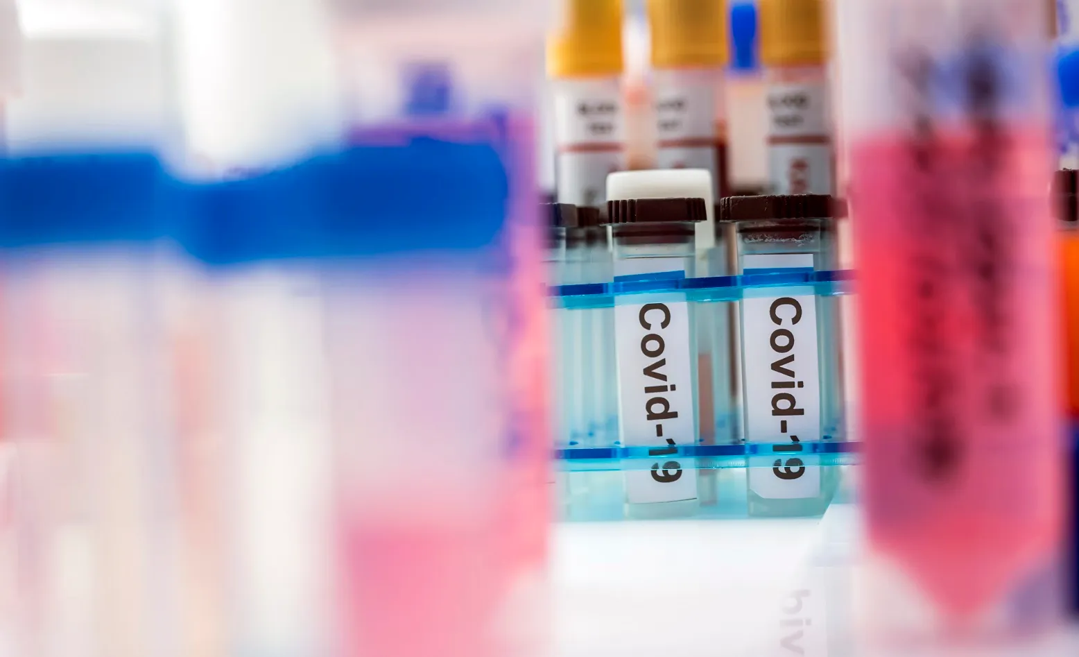 vials with samples of sars cov 2 covid 19 in a res NR6HBA9 новости новости