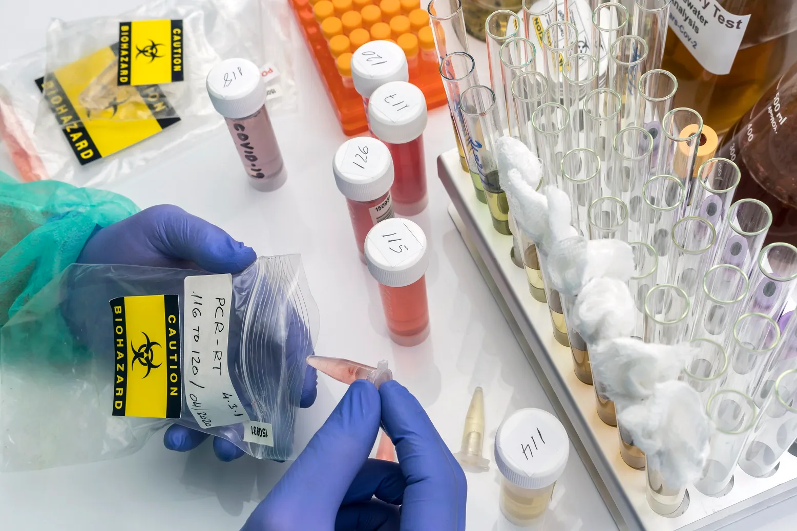 scientist introduces sample of covid 19 in a bioha THCXQAR новости новости