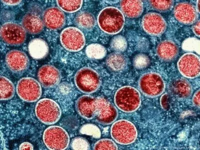 В Германии есть заразившиеся опасным штаммом вируса mpox 8 69958430 403 германия германия