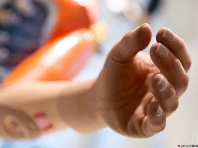 60018899 403.jpg Deutsche Welle протез