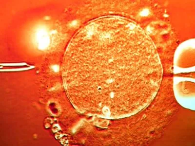 Сперма донора с мутировавшим геном, вызывающим рак, была использована для зачатия почти 200 детей по всей Европе 2 ff8d66c0 d4ed 11f0 8c06 f5d460985095.jpg Новости BBC донор, рак, сперма