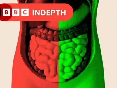 69fdec90 efc5 11f0 b385 5f48925de19a.jpg Новости BBC кишечник