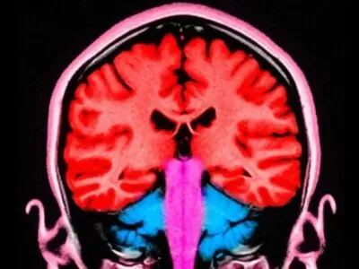 82cce4e0 096c 11f1 83d0 31a7d9d54ca7.jpg Новости BBC мозг