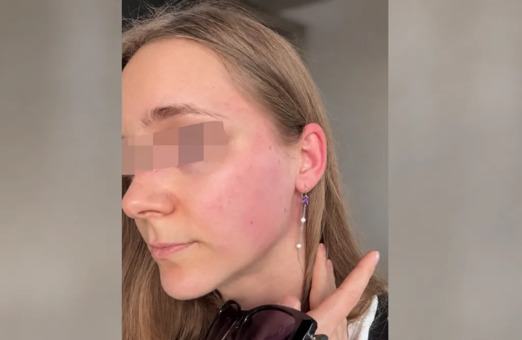 Man Accused of Assaulting Belarusian Tourist Detained in Tbilisi